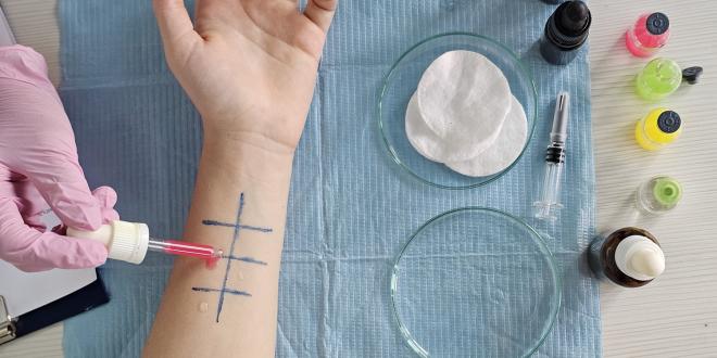The inside of a person's forearm has been marked into a grid to test different allergens.